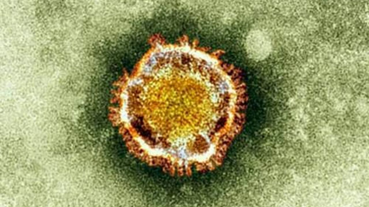 Coronavirus killed 300th victim in Saudi Arabia