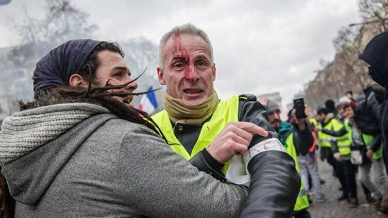 Yellow Vest protestor injured during clashes in Paris