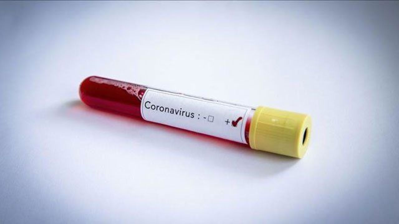 Pakistan&#039;s health minister tests positive for COVID-19