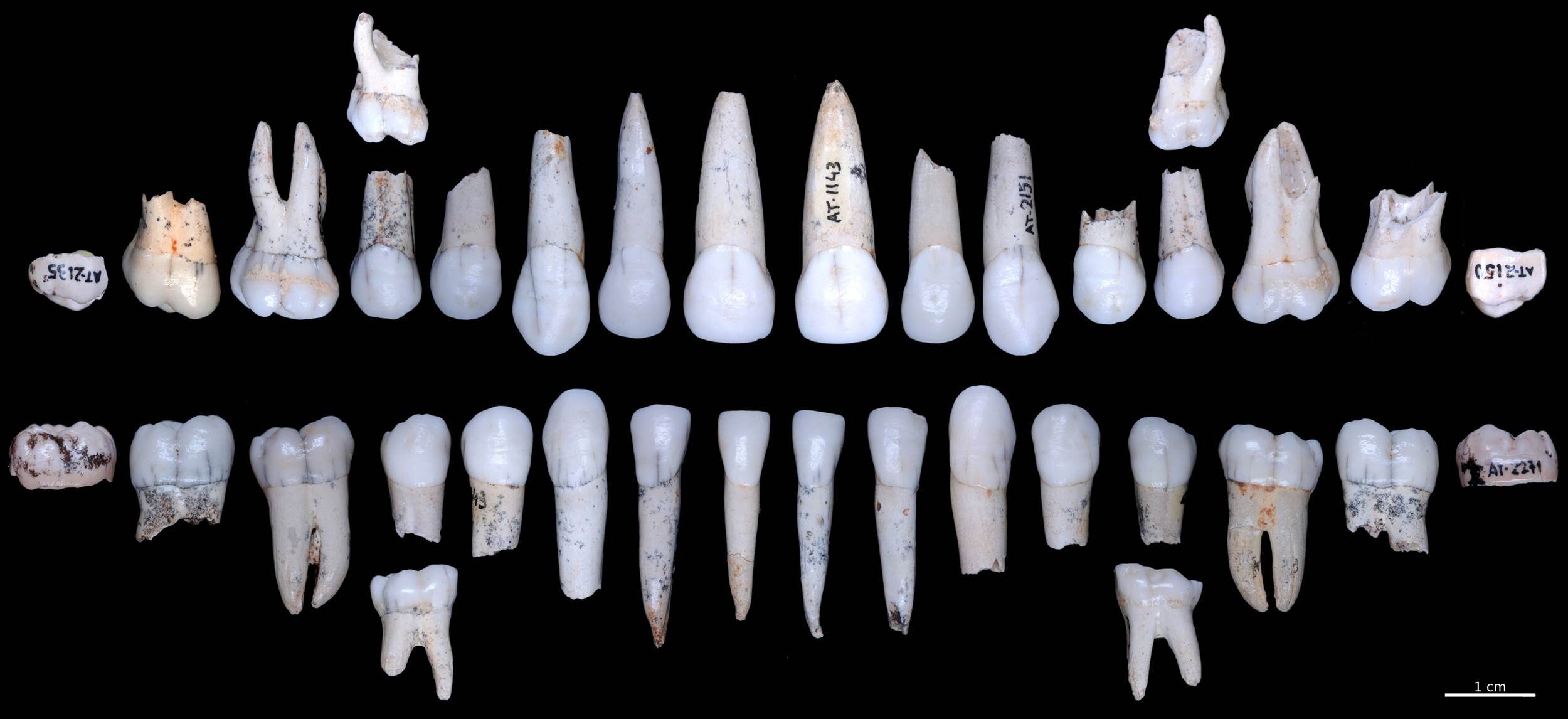 AI revolutionizes dental anthropology research